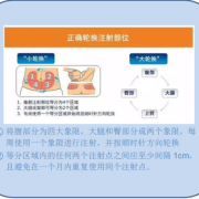 孕期胰岛素怎么打（孕期打胰岛素可以吗）