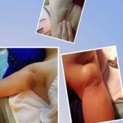 孕妇胸部里面有硬块需要揉散了吗,孕期乳房有硬块怎么办呢