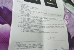 胎儿符合孕35周，但是腹腔内肠管增宽，较宽处内径约21mm，腹腔内部局部回声增强。请问考虑什么情况,胎儿肠管增宽一般都是什么问题