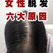 头发脱发怎么办,怀孕期脱发严重怎么办