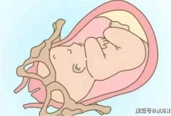 怎么感觉胎儿入盆（孩子入盆的症状）