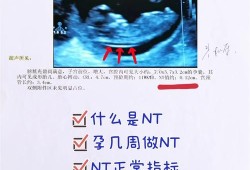 孕期做nt的最佳时间（做nt的周数怎么算）