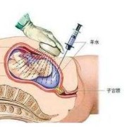 孕期DNA检查胎儿（孕期DNA检查胎儿）