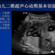 胎儿超声心动（系统检查说宝宝心脏有四根血管，正常是三根，叫我去做心脏结构需要进行针对性胎儿超声心动图检查，请问这是什么原因，问题大不）