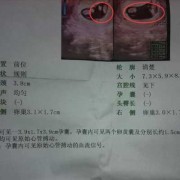 孕期怀男孩有那些征兆（孕期怀男孩有那些征兆吗）
