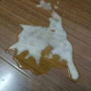 怀孕吐黄水要治疗吗,孕期呕吐黄水发苦是什么原因