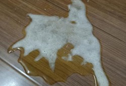 怀孕吐黄水要治疗吗,孕期呕吐黄水发苦是什么原因