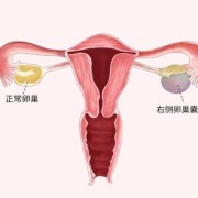 卵巢囊肿对胎儿有影响吗（怀孕了有卵巢囊肿对胎儿有影响吗）