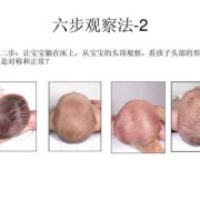 胎儿头扁是什么原因（胎儿头扁是什么原因造成的）