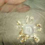 孕期碎石（孕期碎石对胎儿有影响吗）