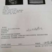 fl是什么中文缩写,fl是胎儿的什么指标