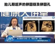 胎儿卵圆瓣（孕25周3天检查心脏  卵圆孔偏大  有坚持的必要吗）
