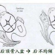 胎儿左枕横位图片（怀孕七个月横位怎么办？我该为宝宝做的措施是什么）