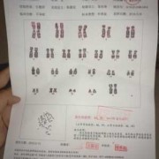 孕妇检查染色体过高有什么问题,胎儿染色体多一条是什么原因造成的