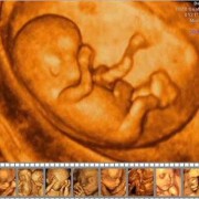 怀孕7个月可以做四维彩超吗,7个月胎儿四维彩超图片欣赏