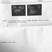 孕45天胎儿发育情况到底是怎样的？孕早期时候，需要怎么检查,怀孕五十多天的胎儿图