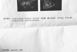 孕45天胎儿发育情况到底是怎样的？孕早期时候，需要怎么检查,怀孕五十多天的胎儿图