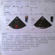 孕期心肌缺血会自愈吗（轻中度心肌缺血能治好吗）