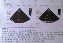 孕期心肌缺血会自愈吗（轻中度心肌缺血能治好吗）