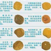 六个多月胎儿图片（6个月小孩一直拉肚子,化验大便正常是怎么回事）