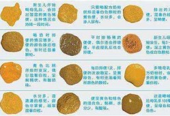 六个多月胎儿图片（6个月小孩一直拉肚子,化验大便正常是怎么回事）