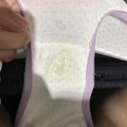 为什么怀孕了初期没有白带呢，出现这种情况算不算正常的,