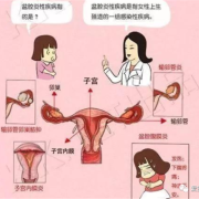 孕期子宫压痛（孕期子宫压痛怎么办）