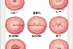 宫颈肥大影响胎儿吗（子宫颈肥大什么意思）