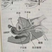 如何打掉胎儿（如何打掉胎儿危害小）