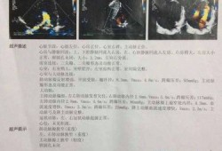 胎儿肺动脉与主动脉内径比例偏小是什么意思,胎儿主肺动脉比例异常的原因没事吧