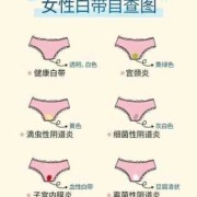 孕期白带发黄是什么原因（孕期分泌物颜色对照表）