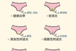孕期白带发黄是什么原因（孕期分泌物颜色对照表）