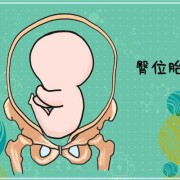 胎儿斜位（胎儿斜位能顺产吗）