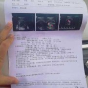 胎儿心脏亮点（怀孕33周，还能做胎儿心脏彩超吗）