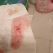 备孕期见红（备孕期见红是没孕上吗）