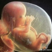 胎儿失聪（胎儿失聪）