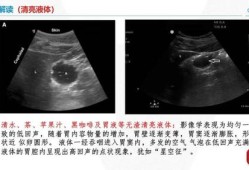 胎儿胃泡的正常值标准差是多少啊？有没有人知道呢,胎儿胃泡小是什么引起的