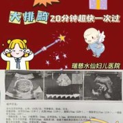 孕期大排畸（做大排畸的最佳时间）