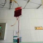 孕期贫血严重（孕妇贫血可以输血吗？输血可以改善贫血对吗）