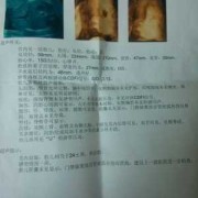 孕妇做四维彩超24周胎儿显示没有胆囊,胎儿没胆囊问题大不大