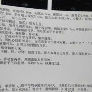 冷热双泡什么意思,胎儿双泡征是什么原因