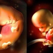 孕八周宝宝在肚子哪个位置,怀孕八周胎儿图片