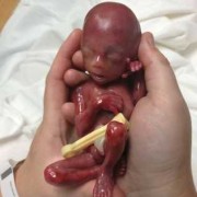 19周宝宝在肚子哪个位置,19周胎儿位置低是什么原因