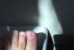 孕期脚红肿（大母脚趾红肿该怎么除理）