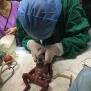 24周胎儿早产能存活吗（24周胎儿早产能存活吗多久）