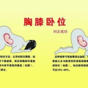 胎儿平躺（两个月宝宝平躺正确姿势）