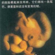 胎儿多大成形（胎儿多大成形正常）