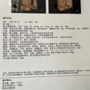 胎儿大排畸（大排畸多少周可以做）