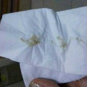 孕期有透明分泌物（孕40周下体流透明粘液是怎么了是要生了吗）
