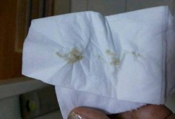 孕期有透明分泌物（孕40周下体流透明粘液是怎么了是要生了吗）